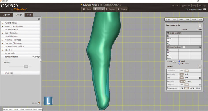Lateral
