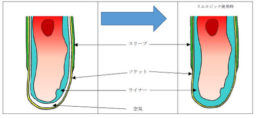 Limblogicimage_2