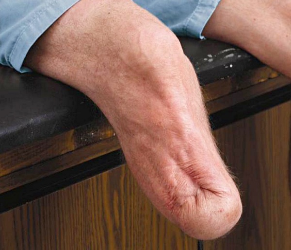 アルファデザインライナー